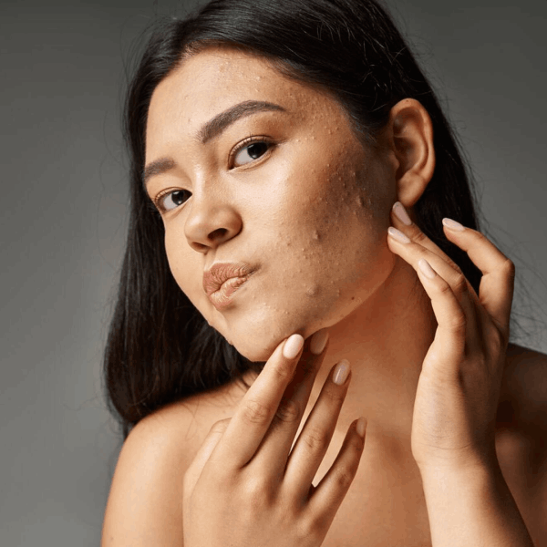 Dra. Cleide Fernandes - Estética - Limeira 